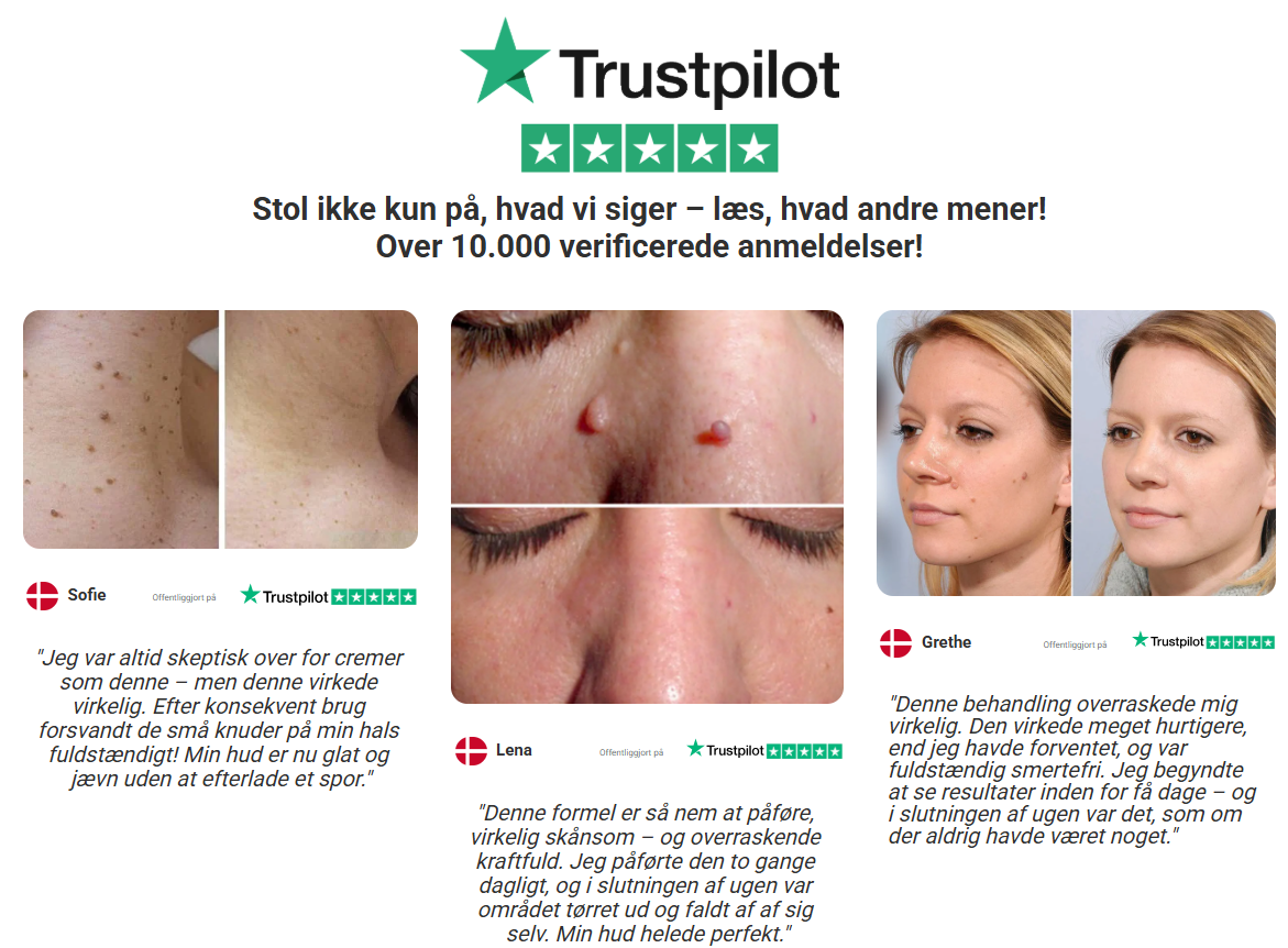VorteFri™ |Hudvedhæng- & Vortecreme | Glat, Vortefri Hud – Synlige Resultater På Få Dage!