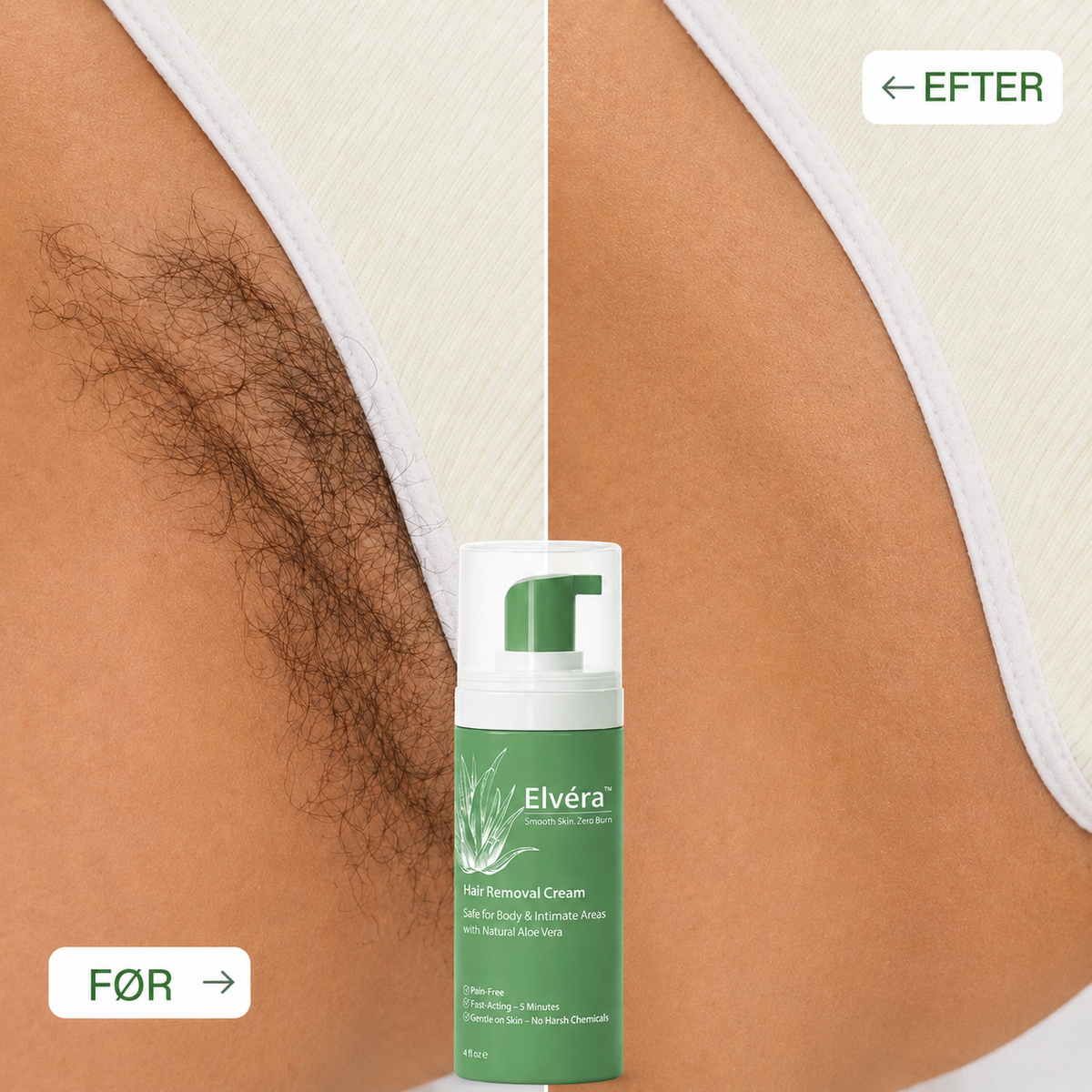 Elvéra™ |BikiniSmooth|Eliminerer Barberbrand, Bumser Og Indgroede Hår Med 95% På Blot 7 Dage