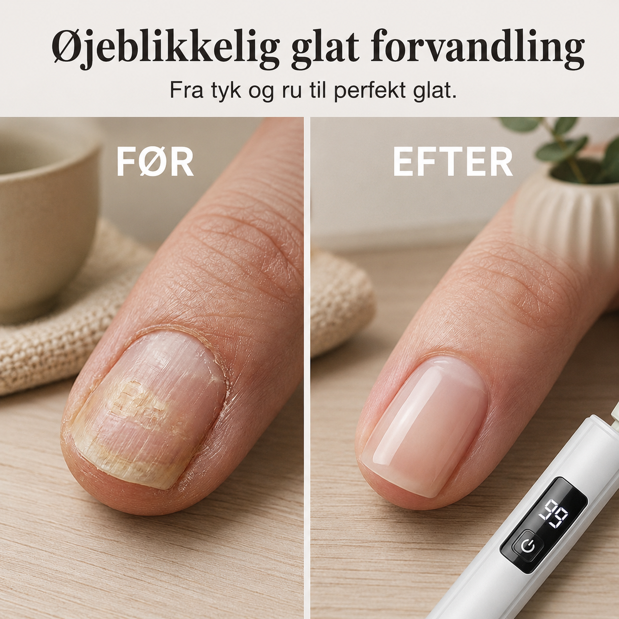 NordicNails™ Elektrisk Neglefræser|🤲Mindst 50% procent💅 |  ✨ Professionel neglepleje med præcision, komfort og flotte resultater – hver eneste gang.