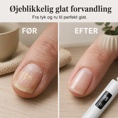NordicNails™ Elektrisk Neglefræser|🤲Mindst 50% procent💅 |  ✨ Professionel neglepleje med præcision, komfort og flotte resultater – hver eneste gang.