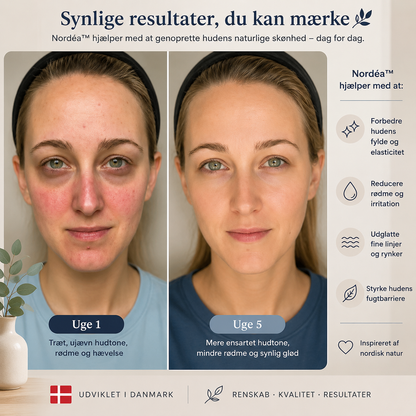 Nordéa™ | 🌿Mindst 50% rabat🌟| ✨ Derfor vælger tusindvis af kvinder Nordéa™ hver eneste dag.