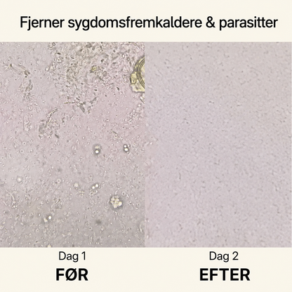 🌿 NordTarm™ | Parasit Balance |🍃 Naturlig støtte til tarmbalance, parasitudrensning og en lettere hverdag
