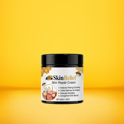 SkinRelief™ Hudreparerende Creme | Lindrer psoriasis og hudirritation på kun 30 minutter!
