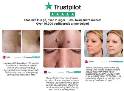 VorteFri™ |Hudvedhæng- & Vortecreme | Glat, Vortefri Hud – Synlige Resultater På Få Dage!
